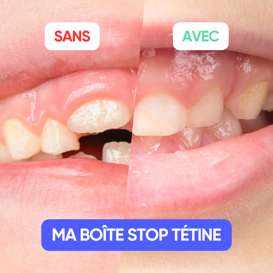 Avant et après utilisation de Ma Boîte Stop Tétine